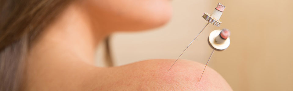 Acupuncture Doubles Fertility Rate